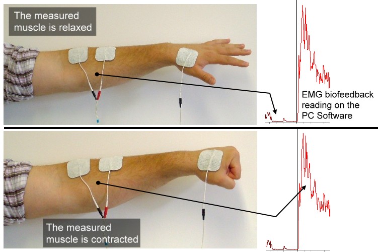 Technique du biofeedback