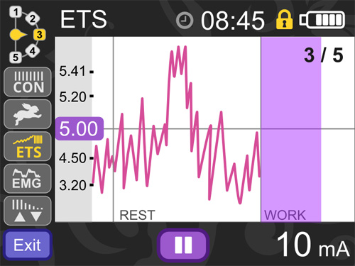 Logiciel Neurotrac - suivi patient en EMG biofeedback