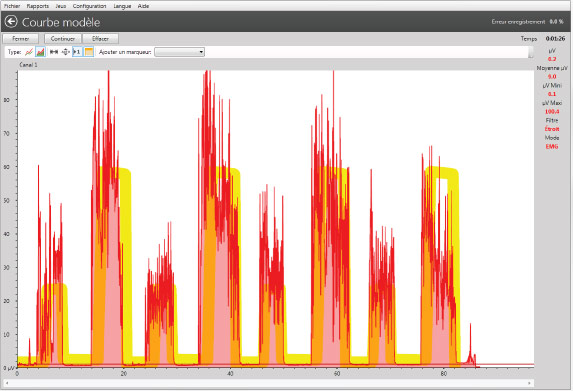 Courbe EMG du travail biofeedback avec logiciel Neurotrac