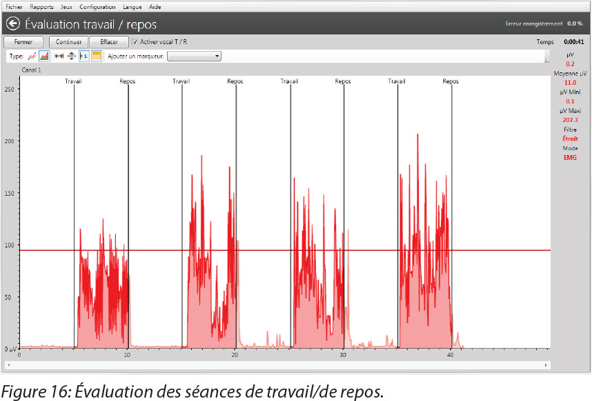 Exemple des exercices EMG avec le logiciel Neurotrac