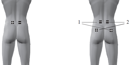 Placement et Position Electrode Compex pour Fesses et Fessier sur  Electrostimulateur.CH 