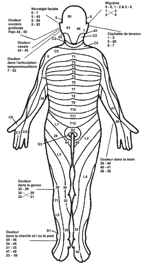 Anatomie du nerf vague et placement de l'électrode bipolaire de